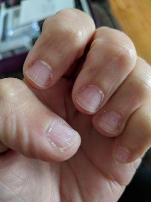 My clean nails after talking the bad polish off