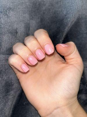 Uneven gel