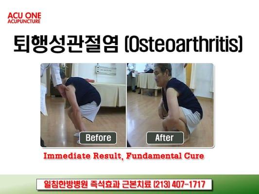 Immediate Result, Fundamental Cure!  Unique Acupuncture Treatment of the Chosun Dynasty(Korean) in the U.S.