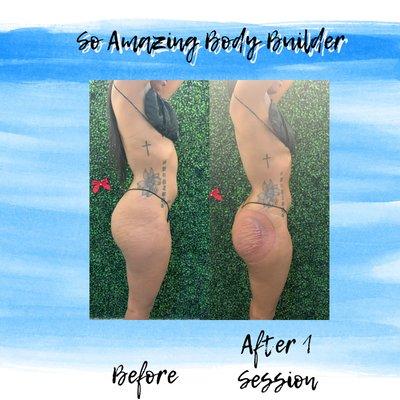 So Amazing Body Contouring