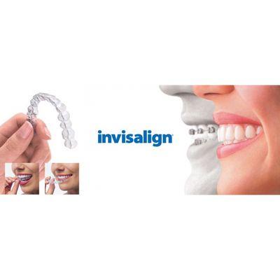 We do in-home/in-office Invisalign also!