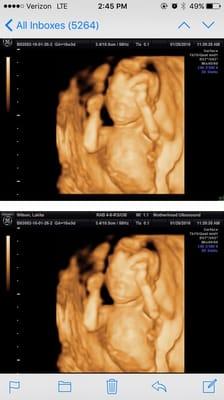 Motherhood Ultrasound