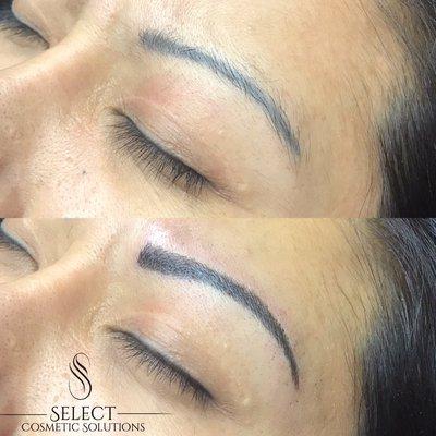 Tattoo correction- microblading