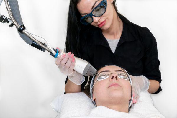 Skin rejuvenation IPL get rid of sun spots and broken capillaries