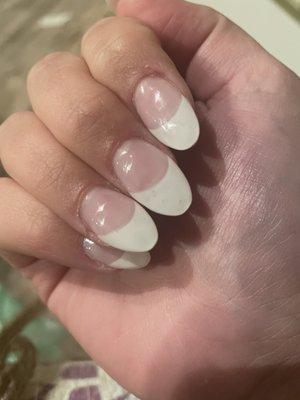 Poorly shaped nails