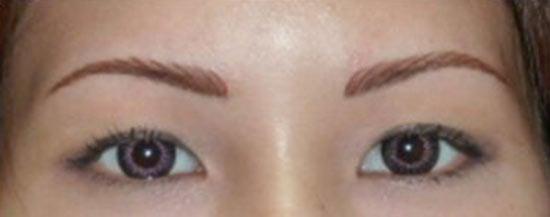 Newly completed eyebrows. Color will soften in about one week.