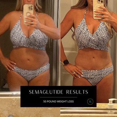 50 POUND WEIGHT LOSS ON SEMAGLUTIDE / OZEMPIC INJECTIONS | Irvine Orange County