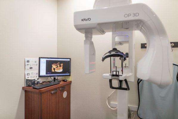 Our CT/cone beam scanner captures and compiles many images to form a precise 3D model of the oral cavity.