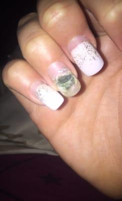 Horrible nail job causes my nail to get an infection.