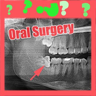 Impacted wisdom tooth x-ray.  Third molar x-ray demonstrates why oral surgery is needed to remove dental impactions.