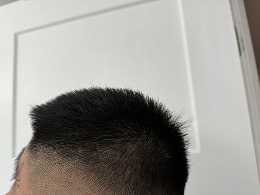 Uneven missed hairs