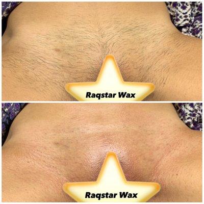 Brazilian Wax!