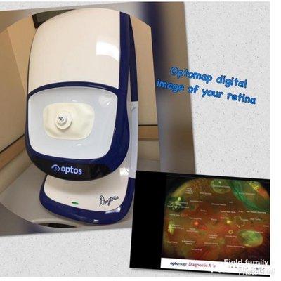 Optos digital imaging of the retina