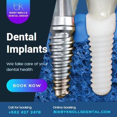 We do implants and Ceramic Implants!