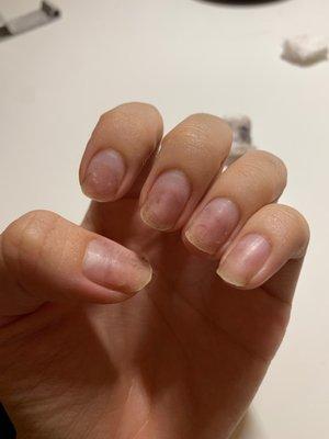 My nails have become all scratched up and ruined, becoming so weak after getting a gel removal from this place. My nails get easily bent.