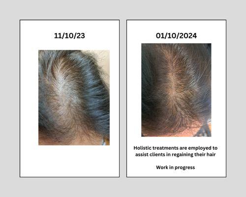 We use holistic treatments to help our clients get their hair back