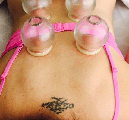 Cupping with Leanne