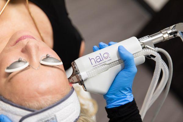 HALO hybrid fractional laser