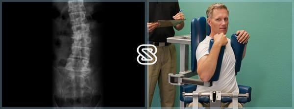 Our use of a combination of isolated strength conditioning, exercises, posture and stretching can help you manage your Scoliosis