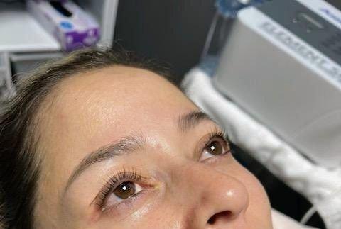 Lash lift