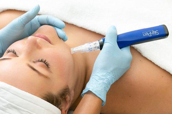 Microneedling with SkinPen is a great way to address tone and texture, and add overall brightness to your skin.