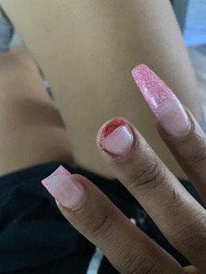 Broken & snapped nail. This set is a week old.