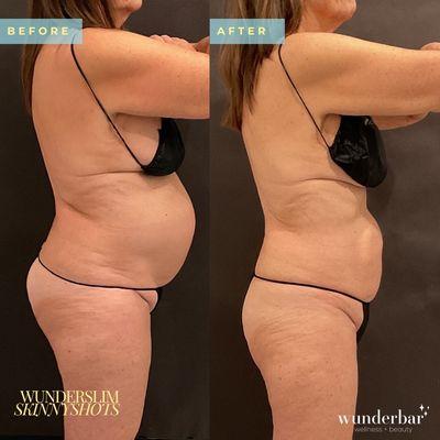 WunderSlim SkinnyShots+ -- 21lbs down in 3 months!