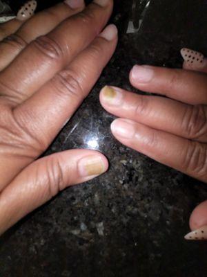 Received a Nasty Green infection from V-Star Nails in Snellville