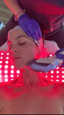 Ultrasound face treatment