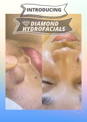 Diamond Hydrofacial Service