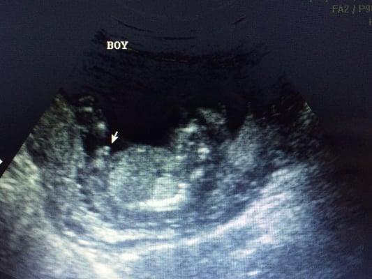 14 weeks and 2 days. We're having a boy!