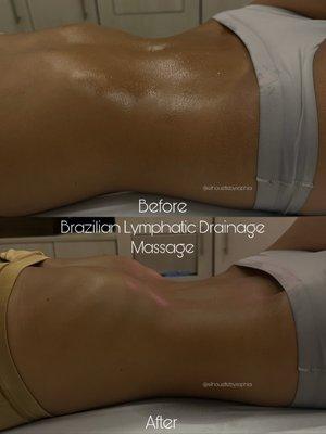 1 hour Brazilian Lymphatic Drainage IG: instagram.com/silhouettebysophia