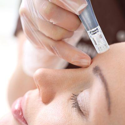 MDPen Microneedling is used to reduce lines, wrinkles, sun damaged skin and the effects of aging.