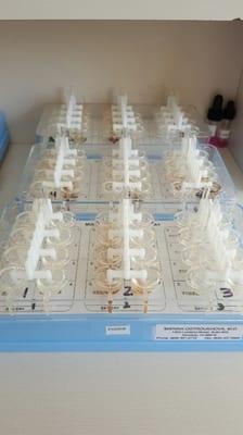 Multi-Prick Testing for Common Foods and Environmental