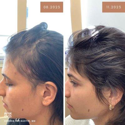 Treating the ROOT causes of hair loss is our philosophy. 
Deep diagnosis first, gorgeous lasting results later.