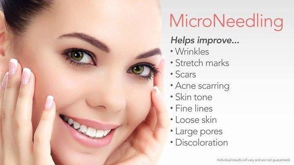 Do you have a few wrinkles, large pores, or how about the dreaded acne scars? Then microneedling might be the secret weapon that you need!