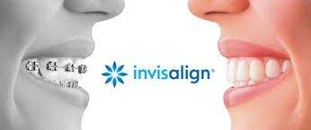 we offer conventional braces and Invisalign