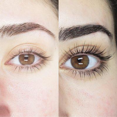 Before and after results of Yumi Lash Lift + Tint. Yumi Lash lift is a keratin treatment that enhances the beauty of your natural eyelashes.