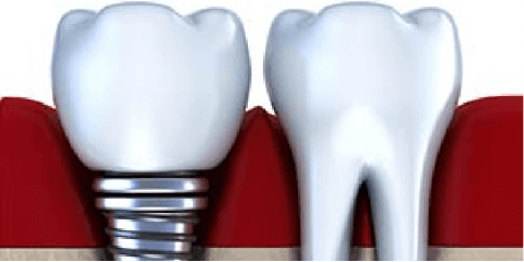 NYC Center for Dental Implants