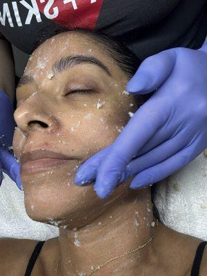 Icy part of the facial