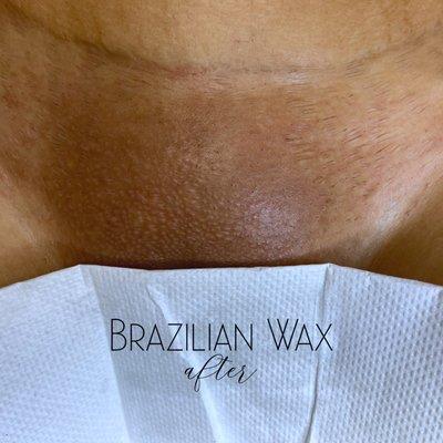 Brazilian Wax