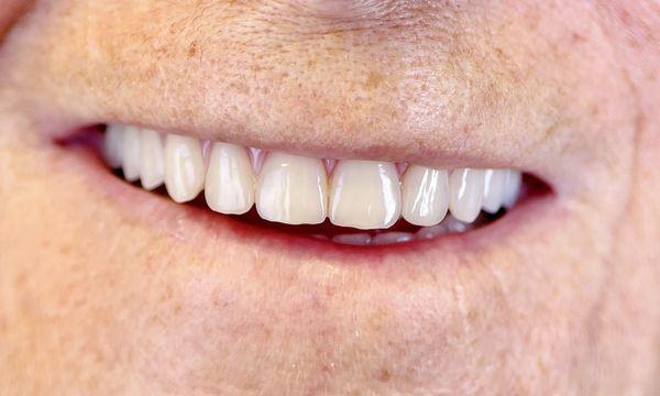 Aesthetic Denture Clinic