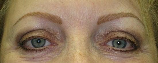 Beautiful new permanent eyebrows. Color will soften in about one week.