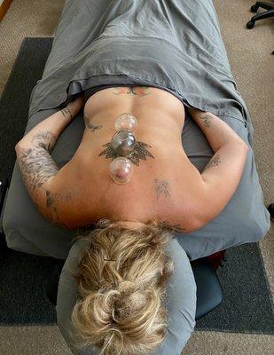 Cupping therapy treatments can be relaxing and have lasting benefits