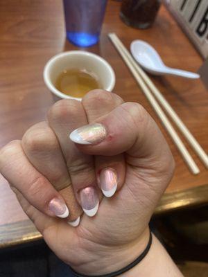 right hand with bandaid over cuticles she cut