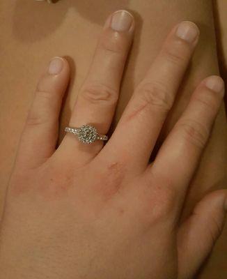 Engagement ring. (Please excuse my cat scratch and nurse hands)