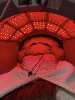 Red light therapy treatment for fine lines, wrinkles, dark spots, texture, and more.