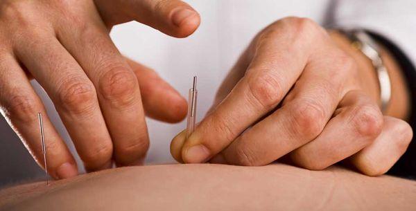 ACA Acupuncture & Wellness - Washington Heights