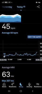 Relaxed heart rate and great sleep after treatment