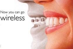 We offer Invisalign